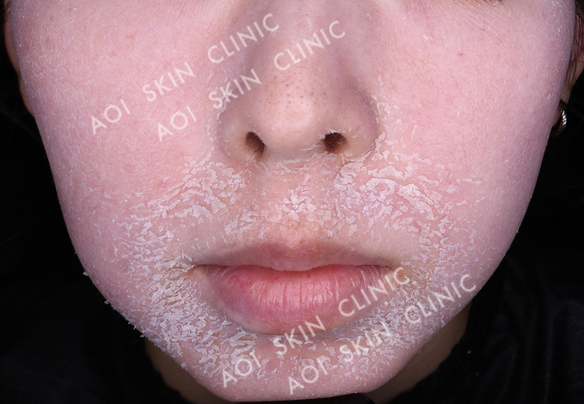 ゼオスキンヘルス – 西三河の皮膚科・美容皮膚科｜あおい皮フ科  