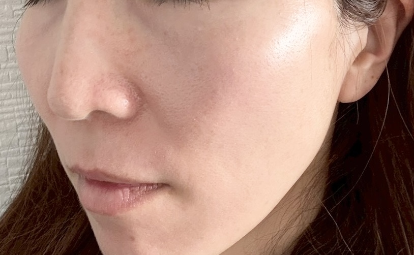 ゼオスキンと私の４ヶ月〜赤みと闘った先に見えた変化〜